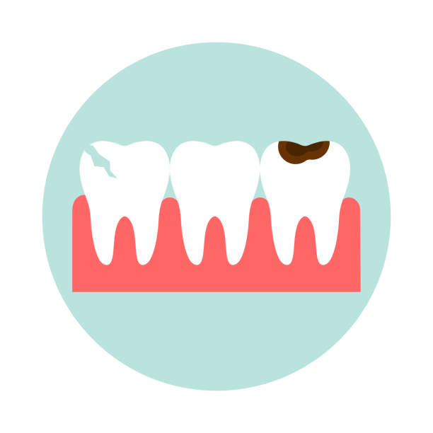 You are currently viewing Quelques avantages d’un traitement orthodontique general